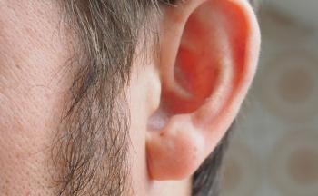 Tips mot tinnitus: Slik fjerner du øresus